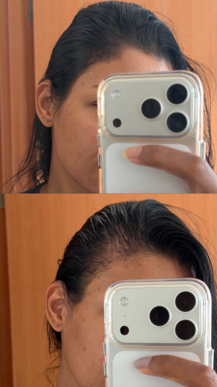 Comparativo de evolução capilar de uma cliente, antes e depois do acompanhamento